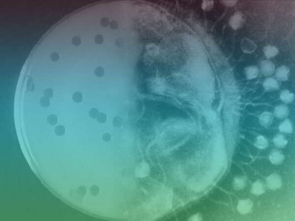 Bacteriophages at different levels of magnification (attached to bacterial cell wall/in petri dish).