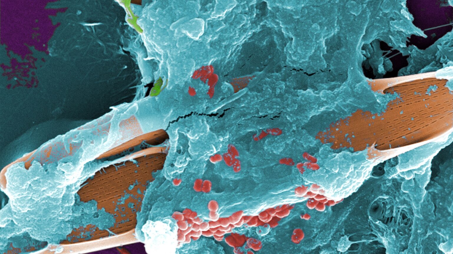 A digitally colorized microscope image of a wild-stream sample showing bacteria, protozoa, and algae. © Janice Haney Carr
